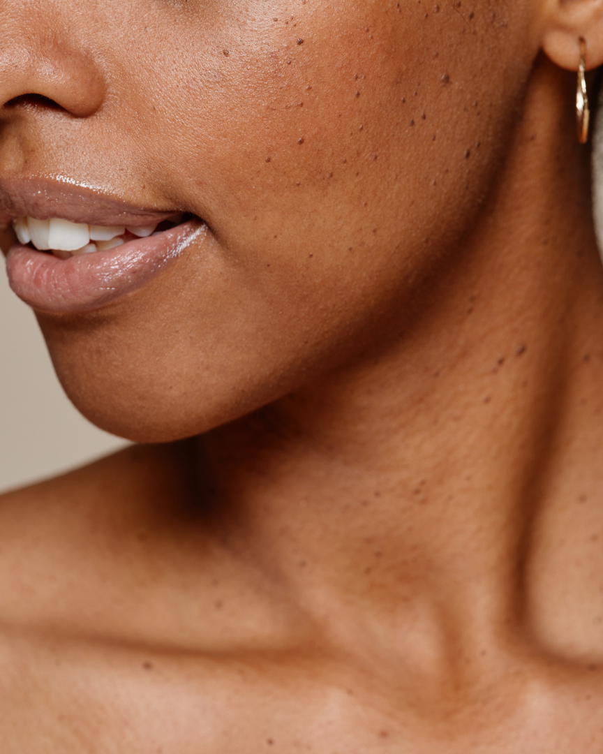 Dry Skin – Urban Oreganics